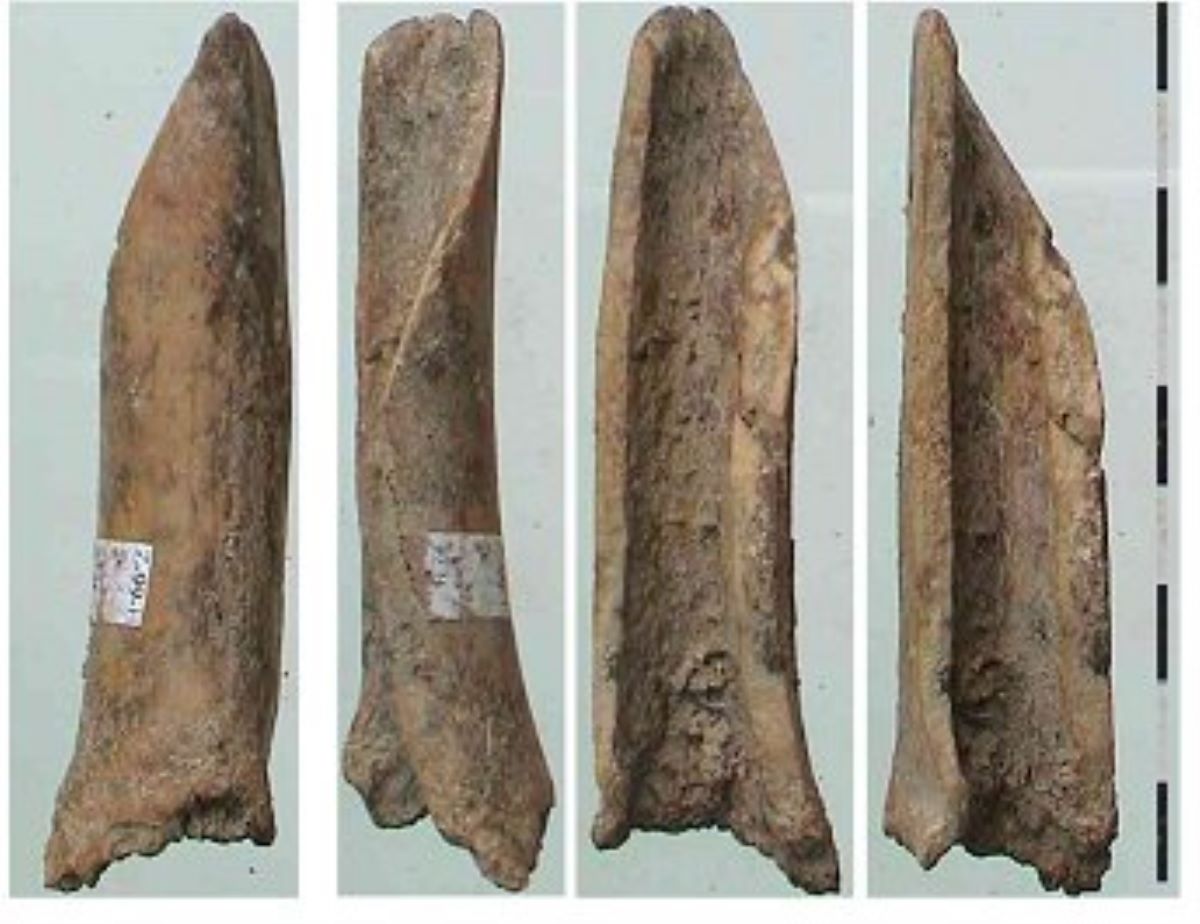 Netezitor pe fragment diafizar de os lung