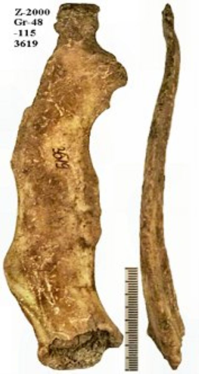 Netezitor pe fragment de os plat (coxal)